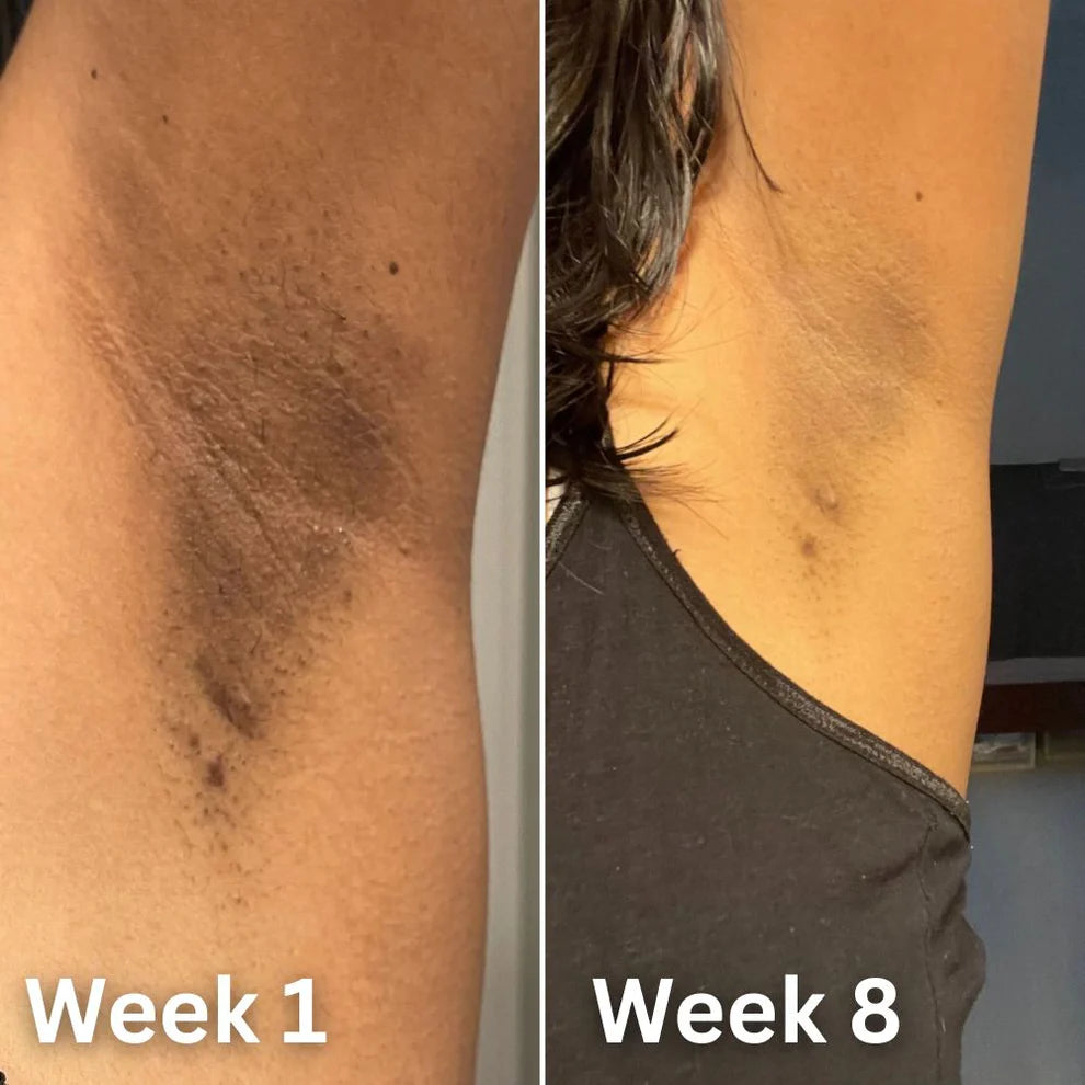 Skin Brightening Deodorant