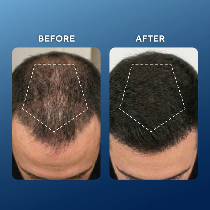 Deoxyribose Scalp Serum