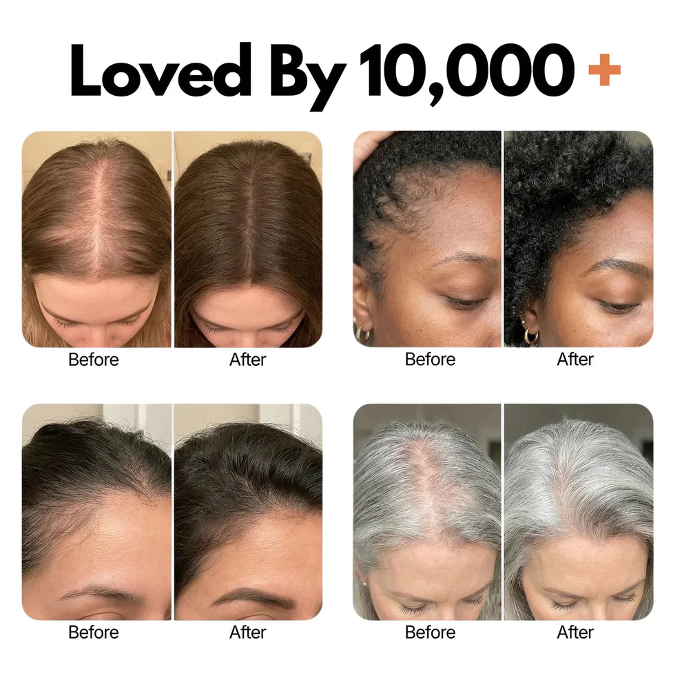 Siora™ Hair Growth Serum