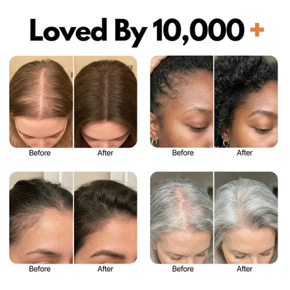Siora™ Hair Growth Serum