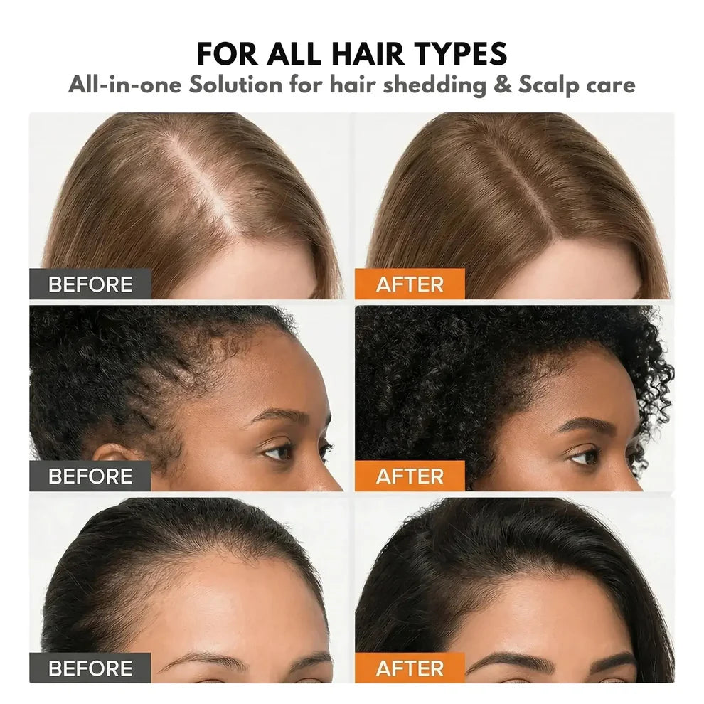 Siora™ Hair Growth Serum