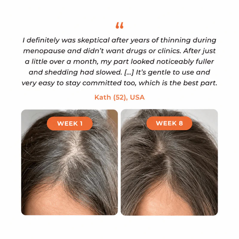 Siora™ Hair Growth Serum