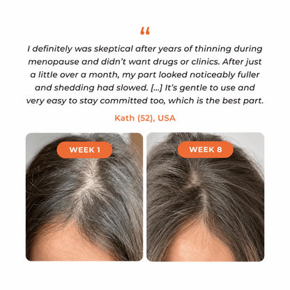 Siora™ Hair Growth Serum